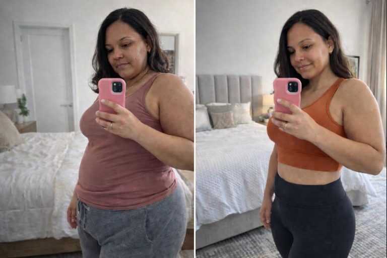 antes depois emagrecimento perda peso