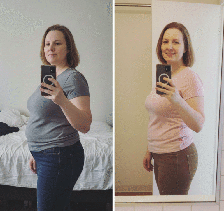 antes depois emagrecimento perda peso