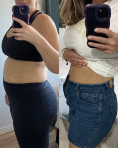 antes depois emagrecimento perda peso